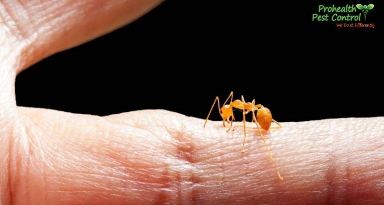 How to Treat an Ant Bite Properly and Safely